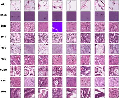 An improved multi-scale gradient generative adversarial network for enhancing classification of colorectal cancer histological images